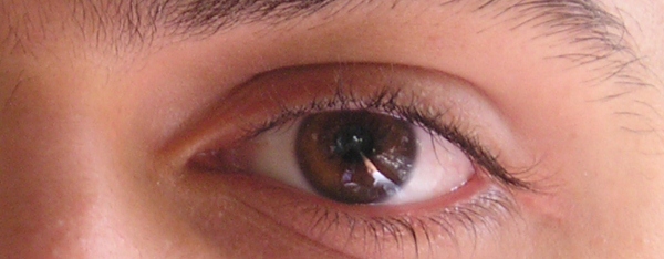 Eye Problem Spots In Vision - floatersgone.com
